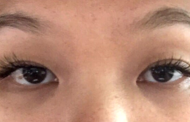 before after