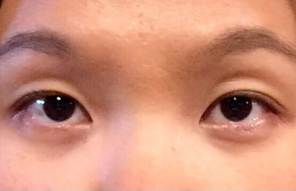 before after