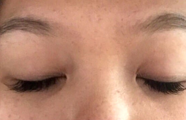 before after
