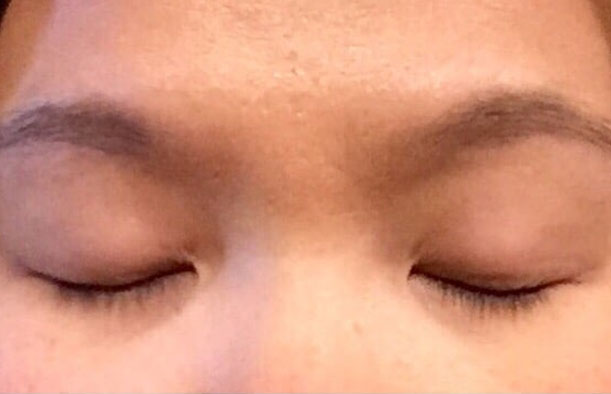 before after