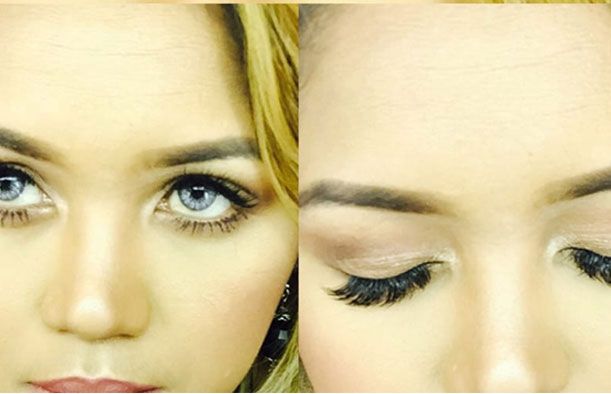 before after