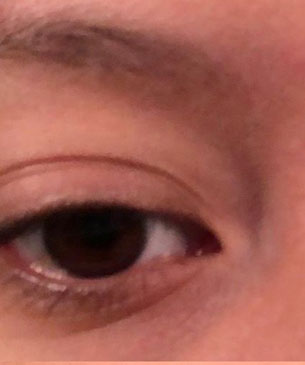 before after