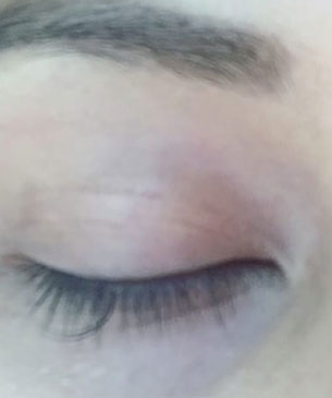 before after