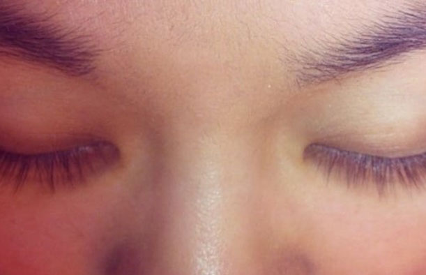 before after