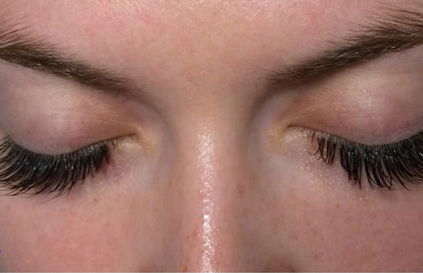 before after